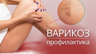 МАССАЖ при ВАРИКОЗЕ | Профилактика