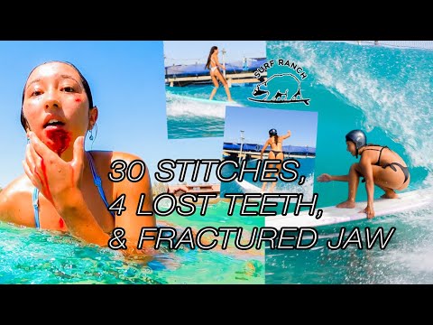 30 STITCHES, 4 LOST TEETH, FRACTURED JAW *KS Surf Ranch Injury* (THANK GOODNESS MY SISTER IS ALIVE!)
