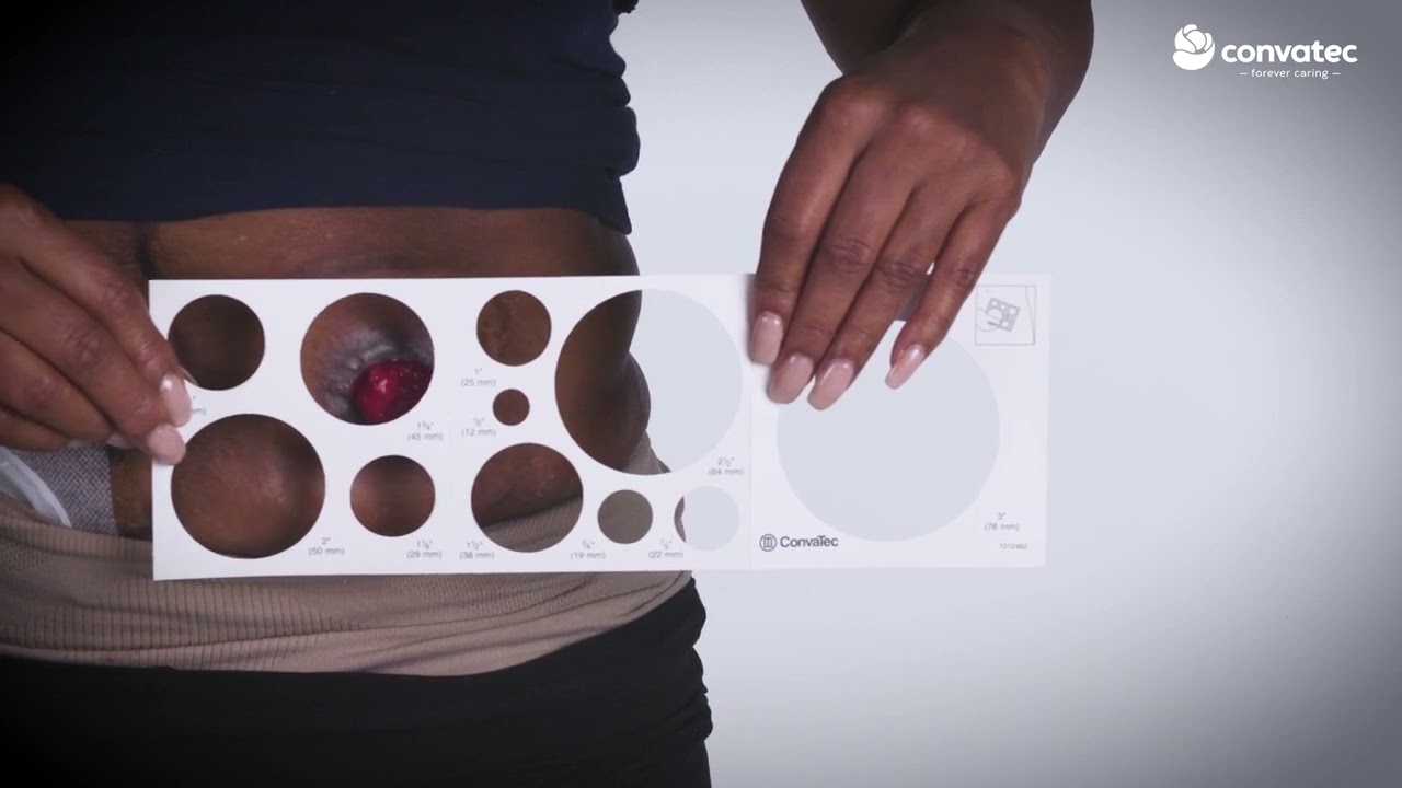 Colostomy Measuring Guide How To Chart Colostomy Bag