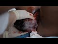 Childbirth, birth, vaginal birth, options,