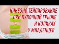 ✅ КИНЕЗИО ТЕЙПИРОВАНИЕ ПРИ ПУПОЧНОЙ ГРЫЖЕ И КОЛИКАХ У МЛАДЕНЦЕВ | Наталья Суворова | BBALANCE