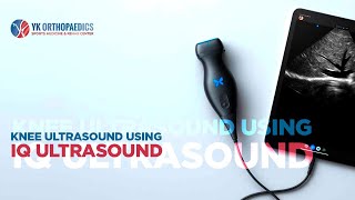 Knee Ultrasound using IQ Ultrasound performed by Orthopedic Surgeon Dr Yasir Khan