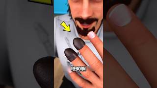 He LOST His Fingertips… Then Changed Rock History 😮🎸🔥