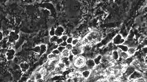 A colony of hematopoietic stem cells
