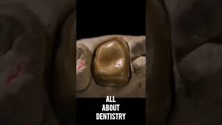Dental motivation. Wax modeling teeth. Dental treatment video. #dental #dentistry #dentaltreatment