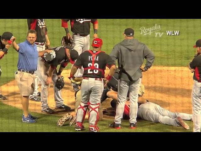 Aroldis Chapman Hit In Face With A Line Drive (Full Video) 