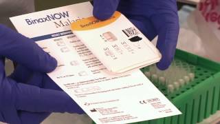 FDA aprovou o primeiro RDT para uso nos EUA BinaxNOW Malaria