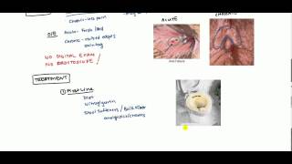 Anal Fissures Lecture for USMLE