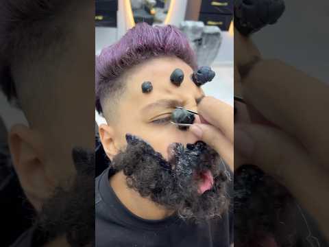 ازالة الحباية المتسلطنة من الخد