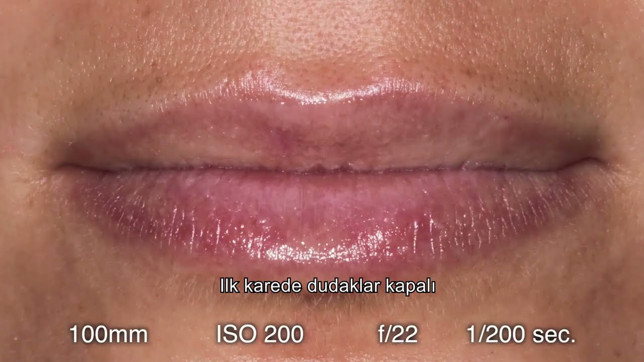 4- İntraoral Fotoğraf Çekimi. 2