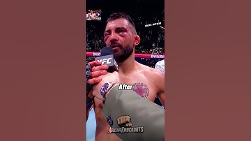 Ufc fighters before and after fights