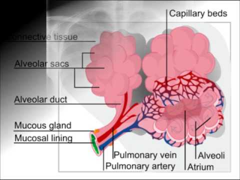 mesothelioma is a benign tumor