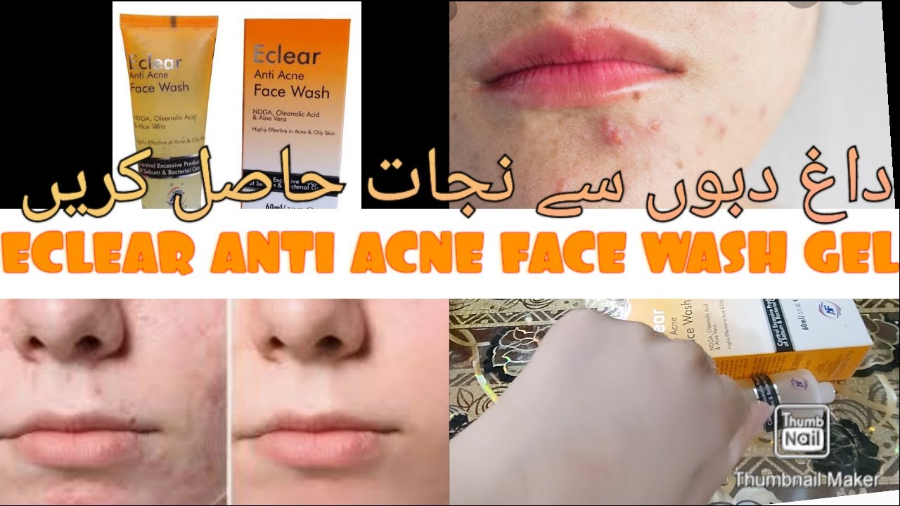 Eclear Anti Acne Face Wash Gel Acne Best Treatment Must Watch YouTube