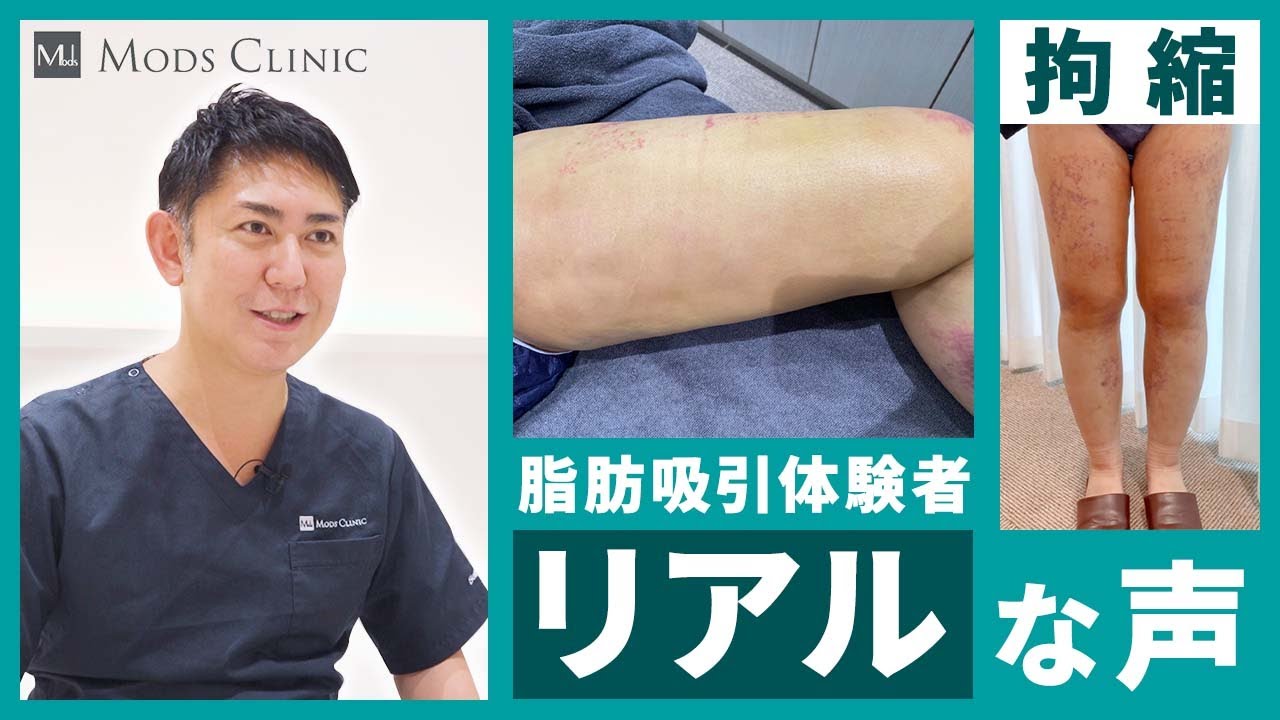 拘縮はどんな症状が現れるのか／北條誠至 医師｜Mods Clinic（モッズクリニック）