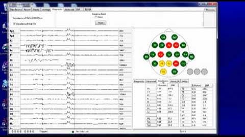 Set-up for DSI EEG Devices