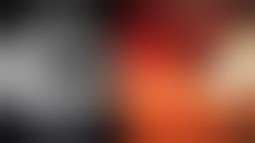 ERCP: MIRIZZI SYNDROME, TYPE V