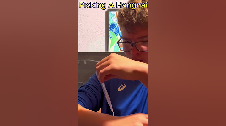 When You Pick A Hangnail #shorts