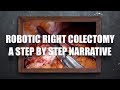 Learn to do a Robotic Right Colectomy