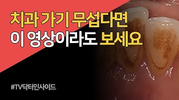 [TV 닥터 인사이드] 치주질환