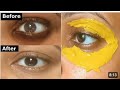 7 Days Fair Eyes, Dark Circles removal pack, 10 minutes Daily