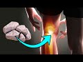 Stone Relieves Knee Pain | Health and Beauty