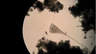 Stentor feeding