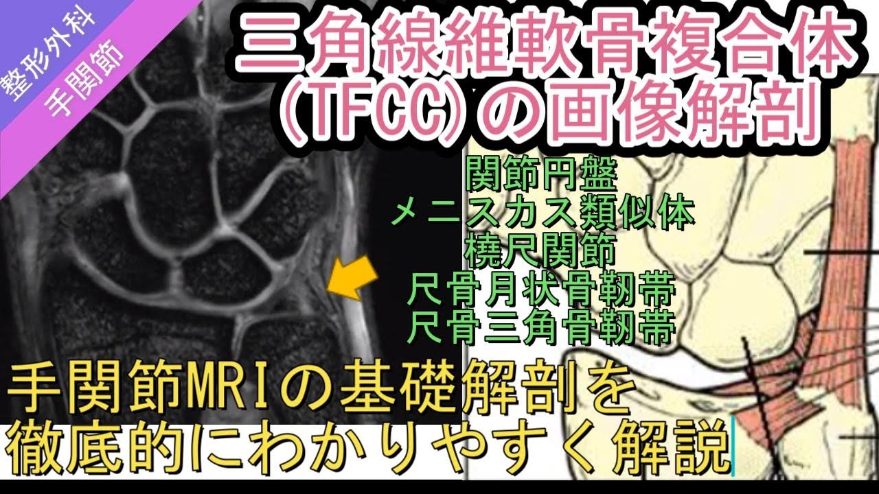 三角線維軟骨複合体(TFCC)の画像解剖