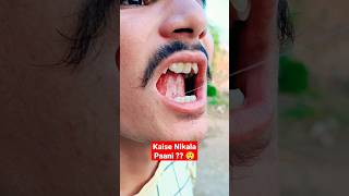 Muh (Jeebh) Me Se Paani Kaise Nikale 😮😲 || #shorts #youtubeshorts #anilcharoliya #viral #ytshort || screenshot 5