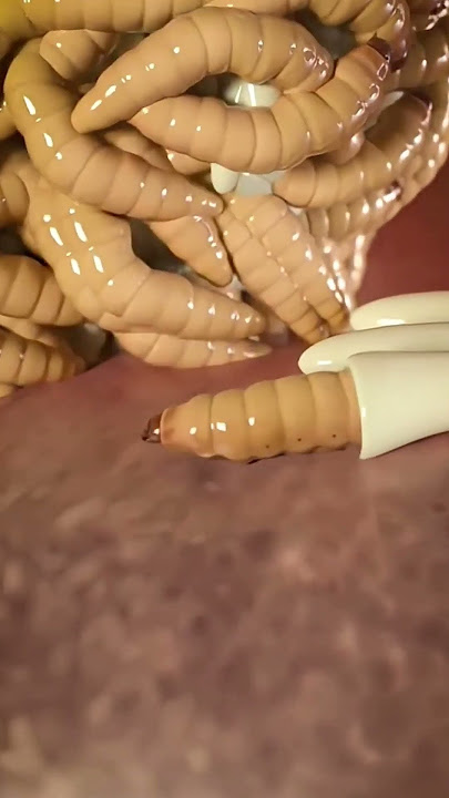 the larva is produced in the ear #shorts