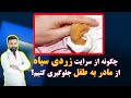 چگونه از سرایت زردی سیاه از مادر به طفل جلوگیری کنیم 