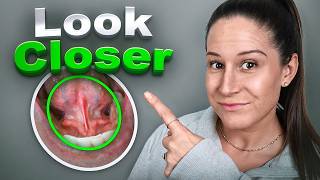 The Diagnosis Doctors Miss
