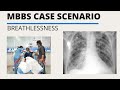 MBBS Case Scenario || Acute Breathlessness || Acute Dyspnea