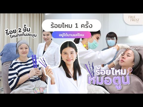 ร้อยไหมอยู่ได้นานแค่ไหน คำถามที่คนไข้มักเข้าใจผิด !