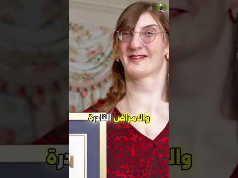 روميسا غيلغي أطول امرأة في العالم تروي قصة تميزها وتحديها للمرض النادر روميسا غيلغي أطول امرأة