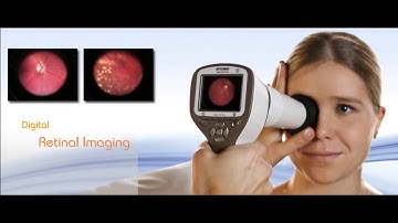 Optomed Smartscope M5