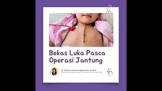 Download Lagu Luka Pasca Operasi Jantung Anak | Seperti Apa? Bagaimana Perawatannya? MP3