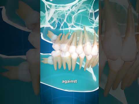 Impacted Wisdom Teeth 😮 (Explained)