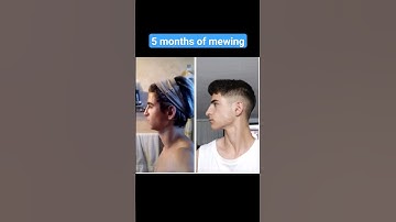 5 months of mewing 😬