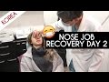 NOSE JOB PLASTIC SURGERY IN KOREA VLOG DAY 2