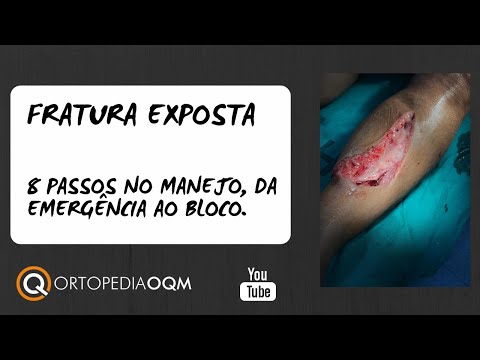 Fratura Exposta  - 8 passos no Manejo! Da emergência ao Bloco Cirúrgico! Ortopedia OQM