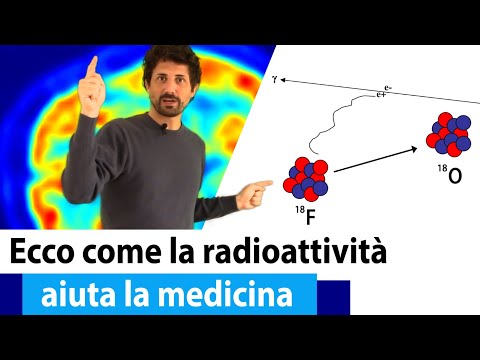 ✅ Cosa è la MEDICINA NUCLEARE? Il lato positivo della radioattività 🚀🚀