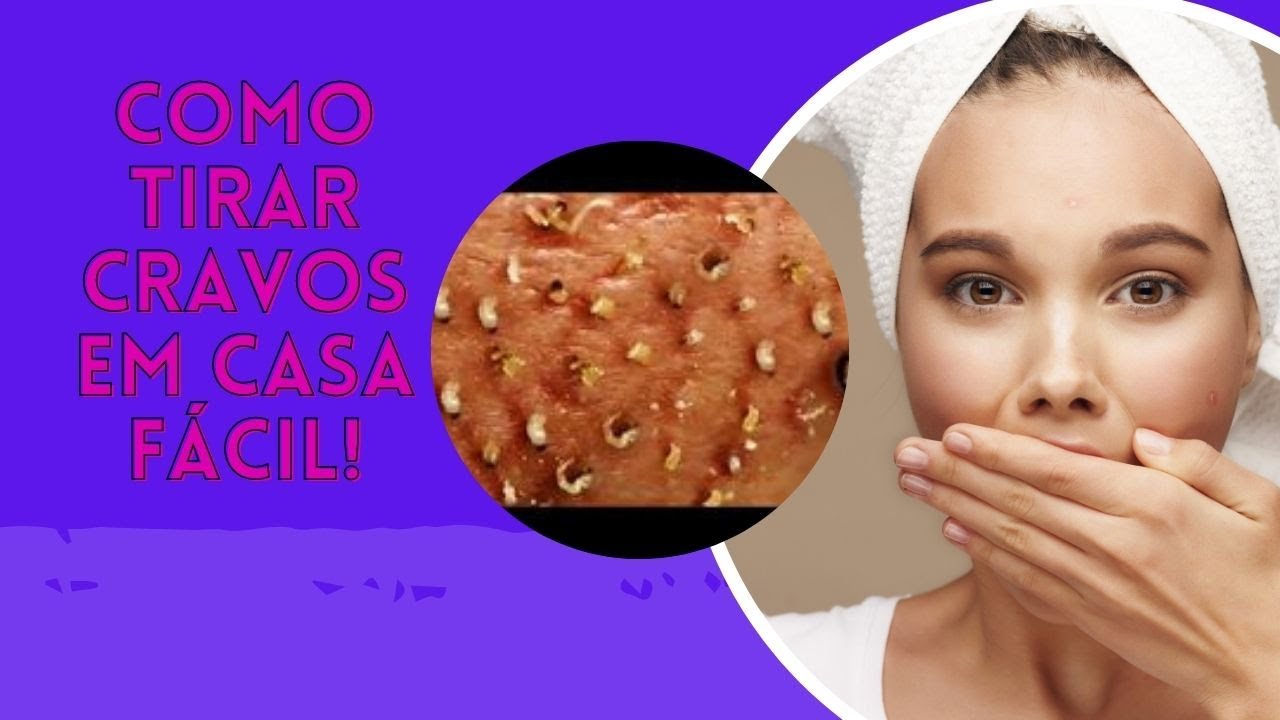 4 ESFOLIANTES CASEIROS PODEROSOS PARA TIRAR CRAVOS DO ROSTO - YouTube