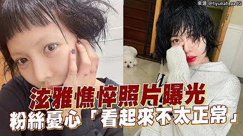 【小娱乐】泫雅憔悴照片曝光 粉丝忧心「看起来不太正常」 - 天天要闻