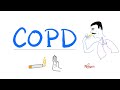 Chronic Obstructive Pulmonary Diseases (COPD) | Pulmonology