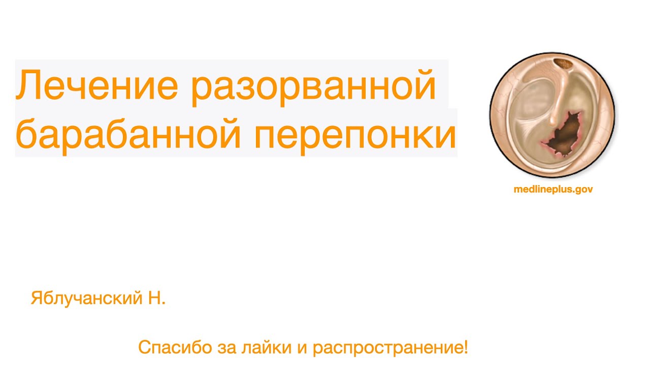 Лечение разорванной барабанной перепонки
