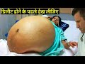 डरफोक लोग ना देखें, ऐसे प्रेगनेंसी को देखकर डॉक्टर भी हिल गए /UNUSUAL PREGNANCY