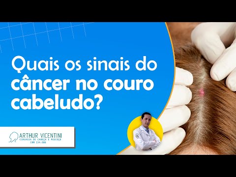 Quais os sinais