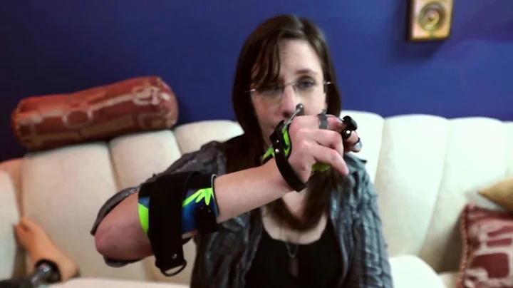 AmputeeOT: What is a tenodesis splint?