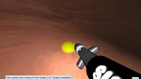 EndoSim Upper GI: Photo and biopsy