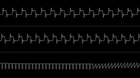 Linus / ViruZ - "64 Forever" | C64 SID